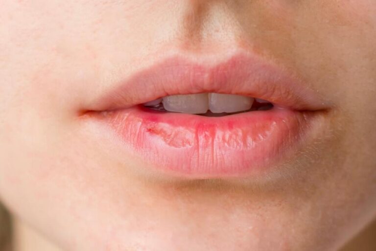 Labios Partidos (Significado Emocional) 《 2026 》 ️